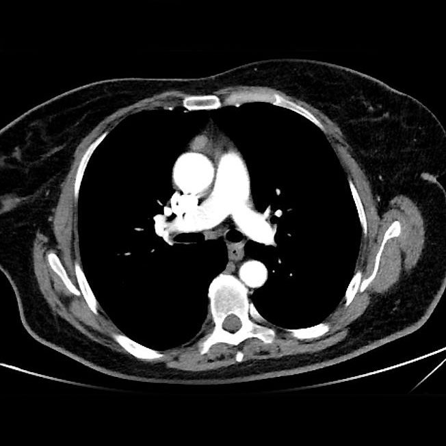 mediasten 2