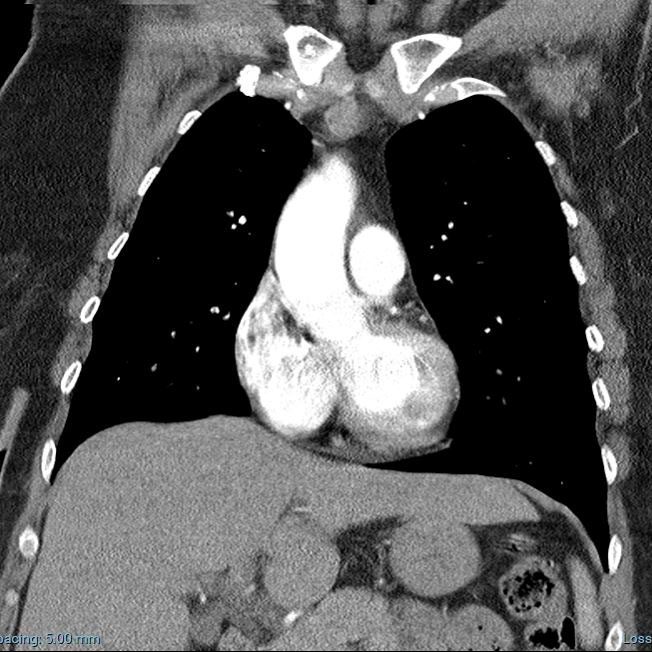 mediasten 3