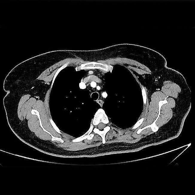mediasten 4